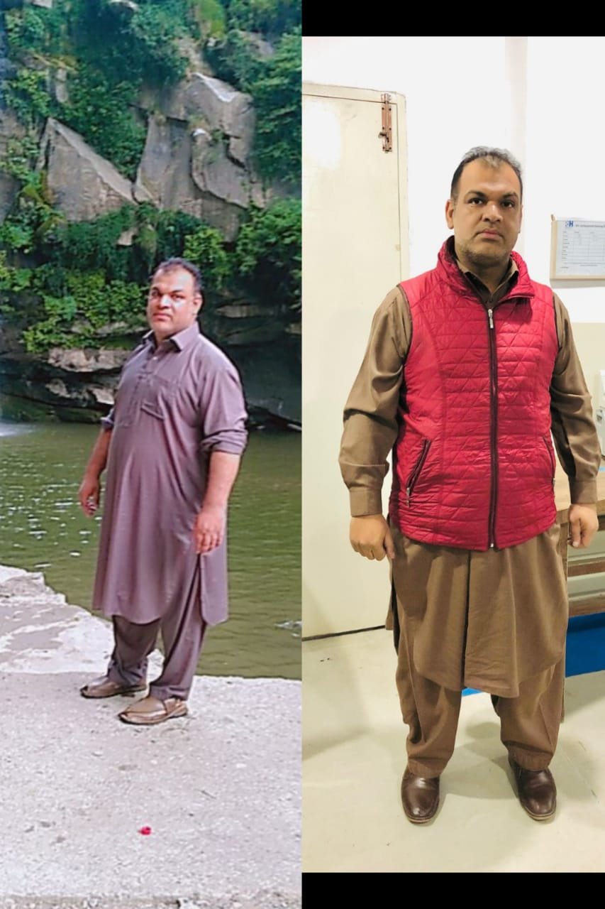 Kirsty Before and After